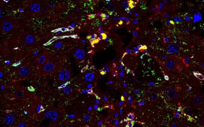 Un trabajo identifica el papel de una proteína celular en la remisión de la fibrosis
