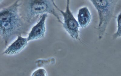 Un estudi liderat pel CSIC avança en l’eliminació selectiva de cèl·lules canceroses mitjançant ‘gàbies’ moleculars