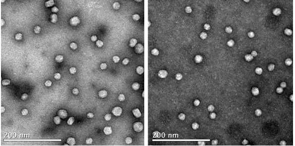 Imatges de microscòpia electrònica que mostren els agregats de LDL en animal hípercolesterolèmic sense tractament (panell esquerre) comparativament amb les LDL (no agregades) d'un animal hipercolesterolèmic tractat amb els nous pèptids. Imatges de microscòpia electrònica que mostren els agregats de LDL en animal hípercolesterolèmic sense tractament (panell esquerre) comparativament amb les LDL (no agregades) d'un animal hipercolesterolèmic tractat amb els nous pèptids.