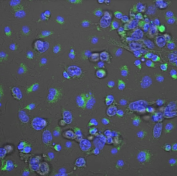 Macrófagos de ratón tratados in vitro con el compuesto MACTIDE-V que han sido expuestos a células de cáncer de mama (en verde) / Pablo Scodeller.